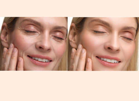 Anti - Aging Series